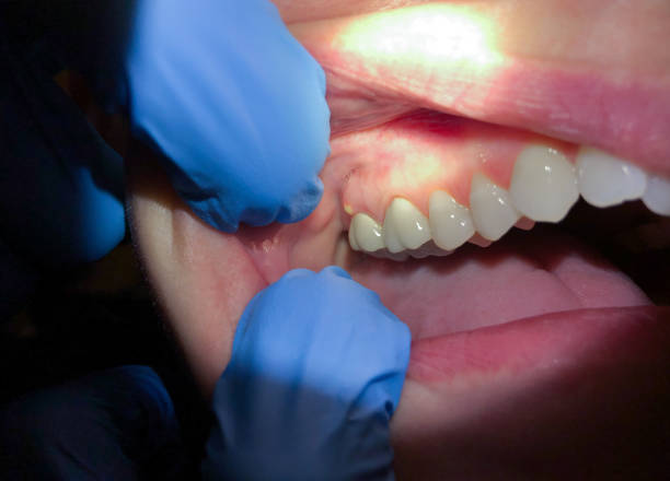 Best Broken or Chipped Tooth Repair in Jamestown, NC